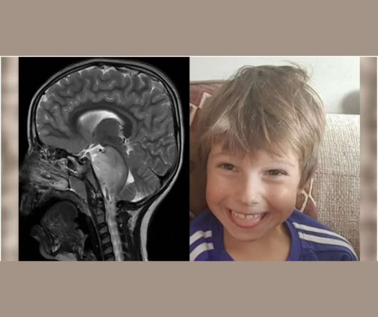 Doktori su rekli da će šestogodišnji dječak umrijeti, ali on j